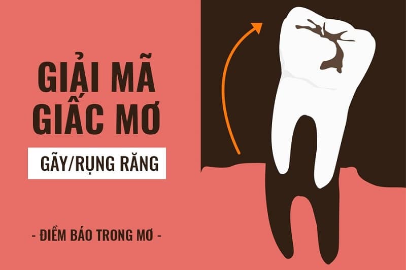 Nằm mơ thấy rụng răng có ý nghĩa và điềm gì